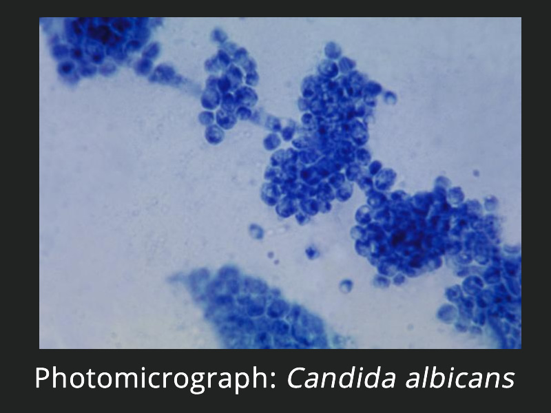https://www.faim.org/sites/default/files/images/CandidaAlbicansPhotomicrograph.jpg