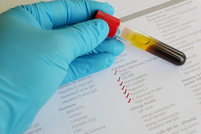 Meaningful Blood Tests for Cardiovascular Risk Assessment Foundation Meaningful Blood Tests for Cardiovascular Risk Assessment Foundation
