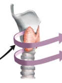 Illustration showing location of the thyroid and parathyroid glands in a person's neck.