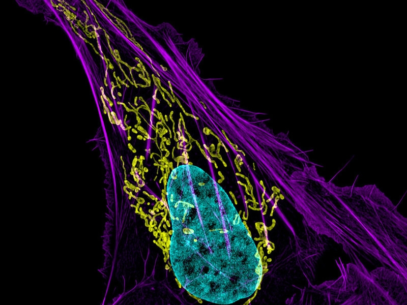 Bone cancer cell