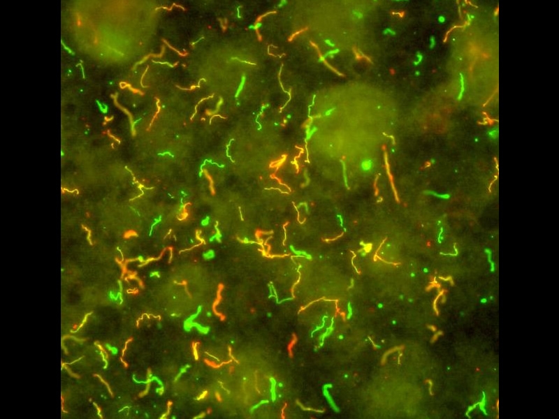 Lyme Disease Bacteria, Borrelia burgdorferi