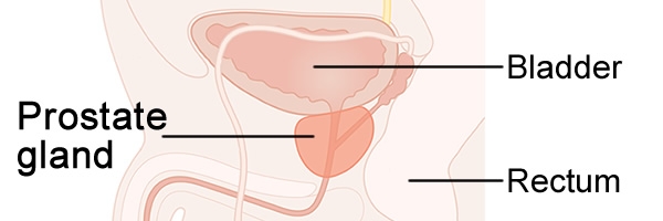 medical diagram of the prostate gland below the bladder and next to the rectum