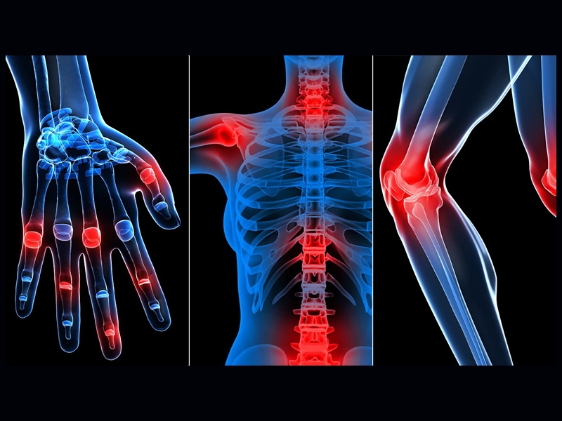 blue outlines of hand, torso, knee with painful joints highlighted in red