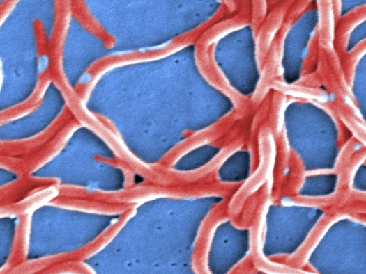 Borrelia burgdorferi bacteria