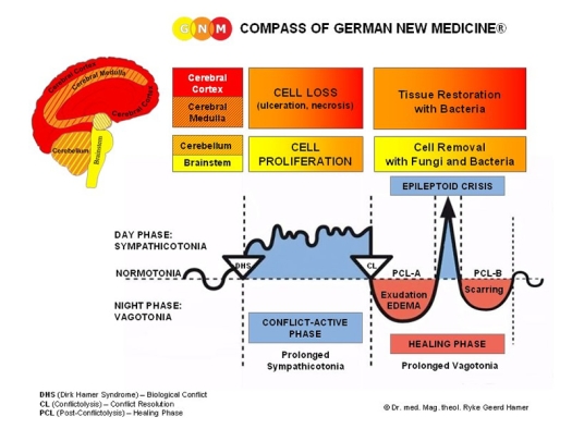 Dr Hamer's chart illustrating cell loss and cell proliferation
