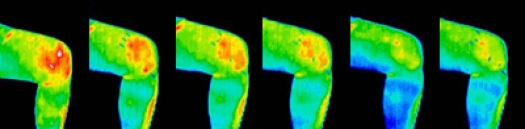 thermal images of knees