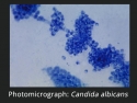 image shows several groups of small round blue bunches of Candida albicans
