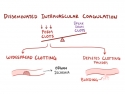 Illustration showing DIC as a condition that leads to both widespread clotting and bleeding.