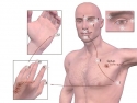 illustration of male head and torso, eye, hand showing tapping points on face, around eye, fingers, chest, under arm