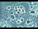 Entamoeba gingivalis microscopy