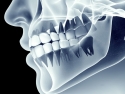 X-ray illustration of jaw and teeth