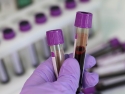 Medical lab, lab tech's hand in purple glove holding two tubes of blood with additional tubes ready for testing in the background