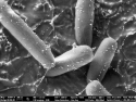 E.coli bacteria, dotted with silver nanoparticles