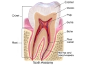 Illustration of a human tooth with labels showing crown, root, enamel, dentin, pulp, gums, bone, root canal, and nerves and blood vessels